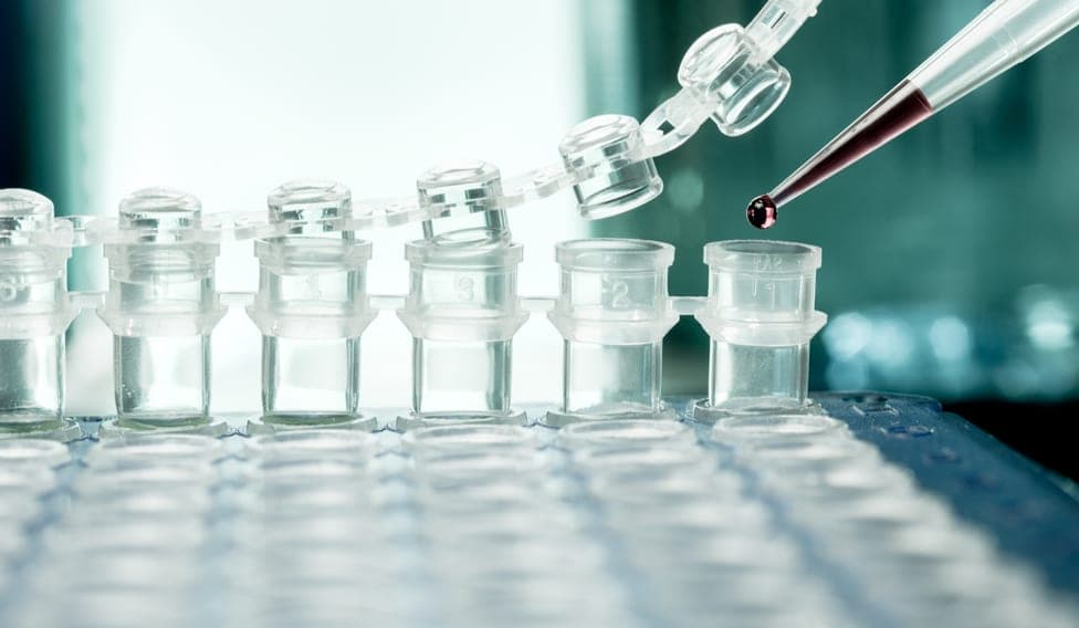 A pipette dispensing a sample in a laboratory